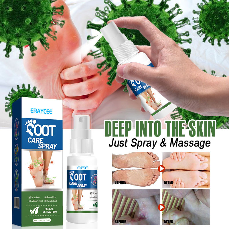 ERAYCEE cross-border plant foot deodorant spray foot anti-itching foot odor Moisturizing Care Spray