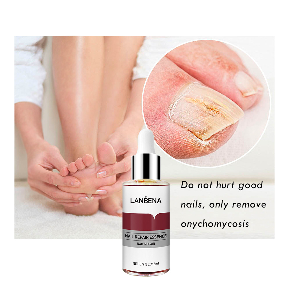LANBENA Blue Beina Nail Care Solution with 1 Small File 15ml (New Package)