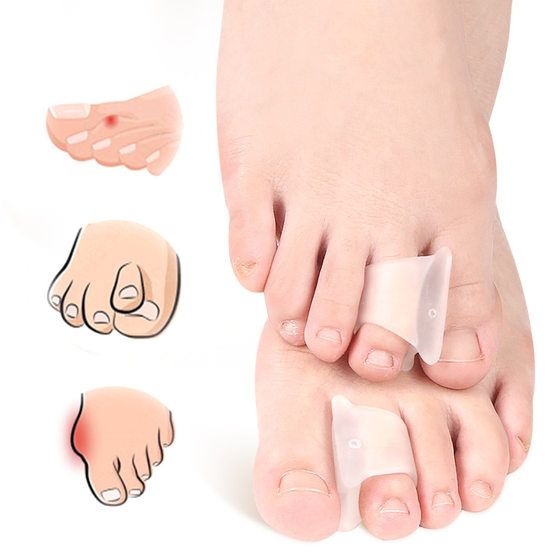 New toe bending orthosis hammer toe straightener sebs toe straightener anti-pain toe pad split toe sleeve
