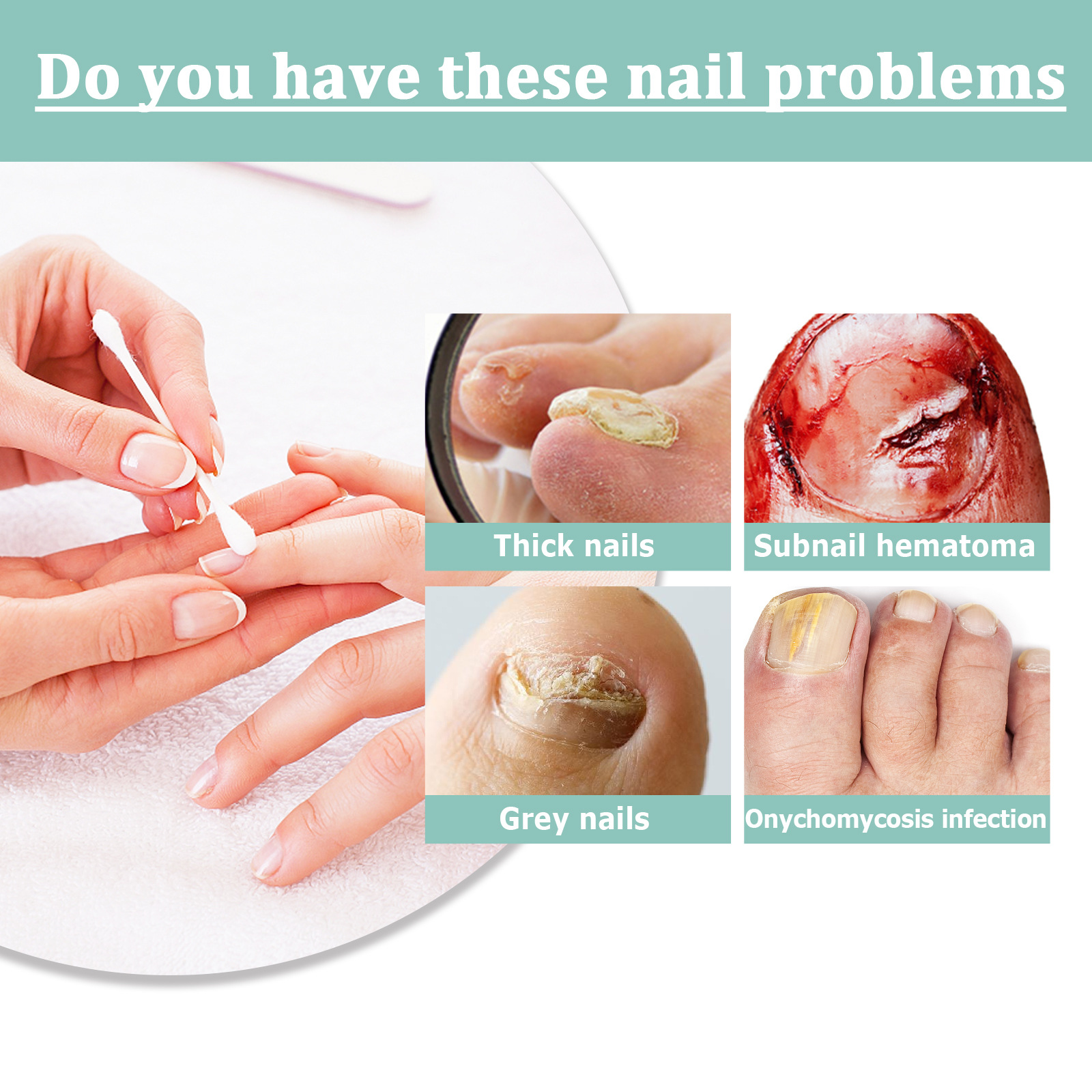 South Moon nail repair pen gray nail care solution cleaning bright nail thickening gray nail repair pen