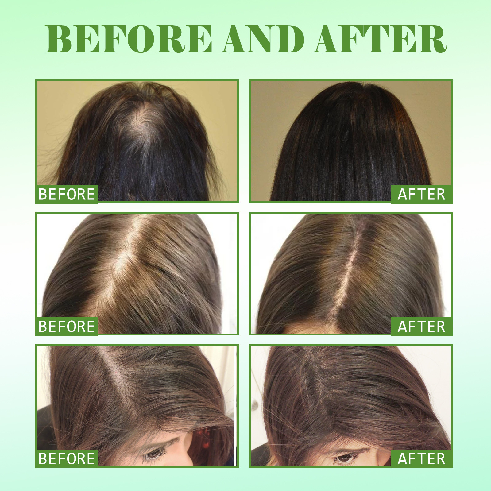 EELHOE Rosemary hair care essential oil hair repair damaged anti-hair fixing dense hair soft hair care essential oil