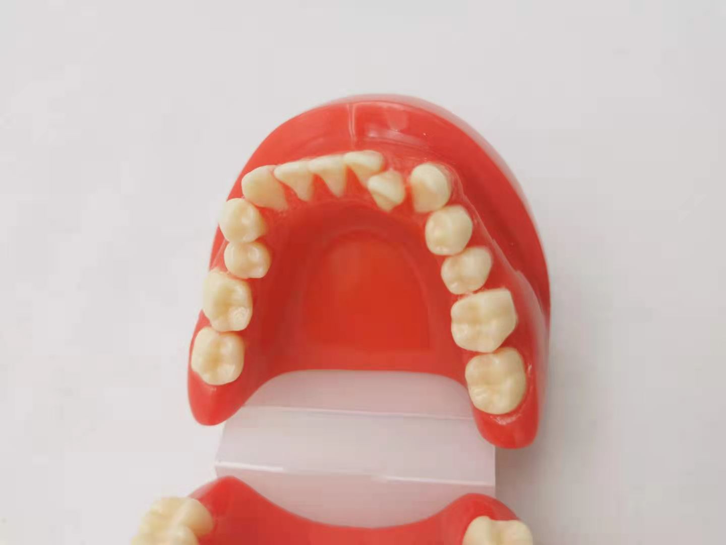 Dental red wrong jaw model oral teaching model children wrong jaw model dental wrong jaw buck teeth