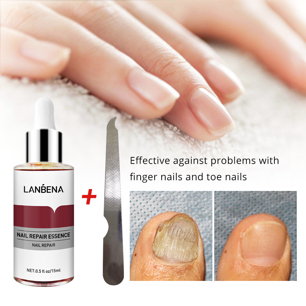 LANBENA Blue Beina Nail Care Solution with 1 Small File 15ml (New Package)