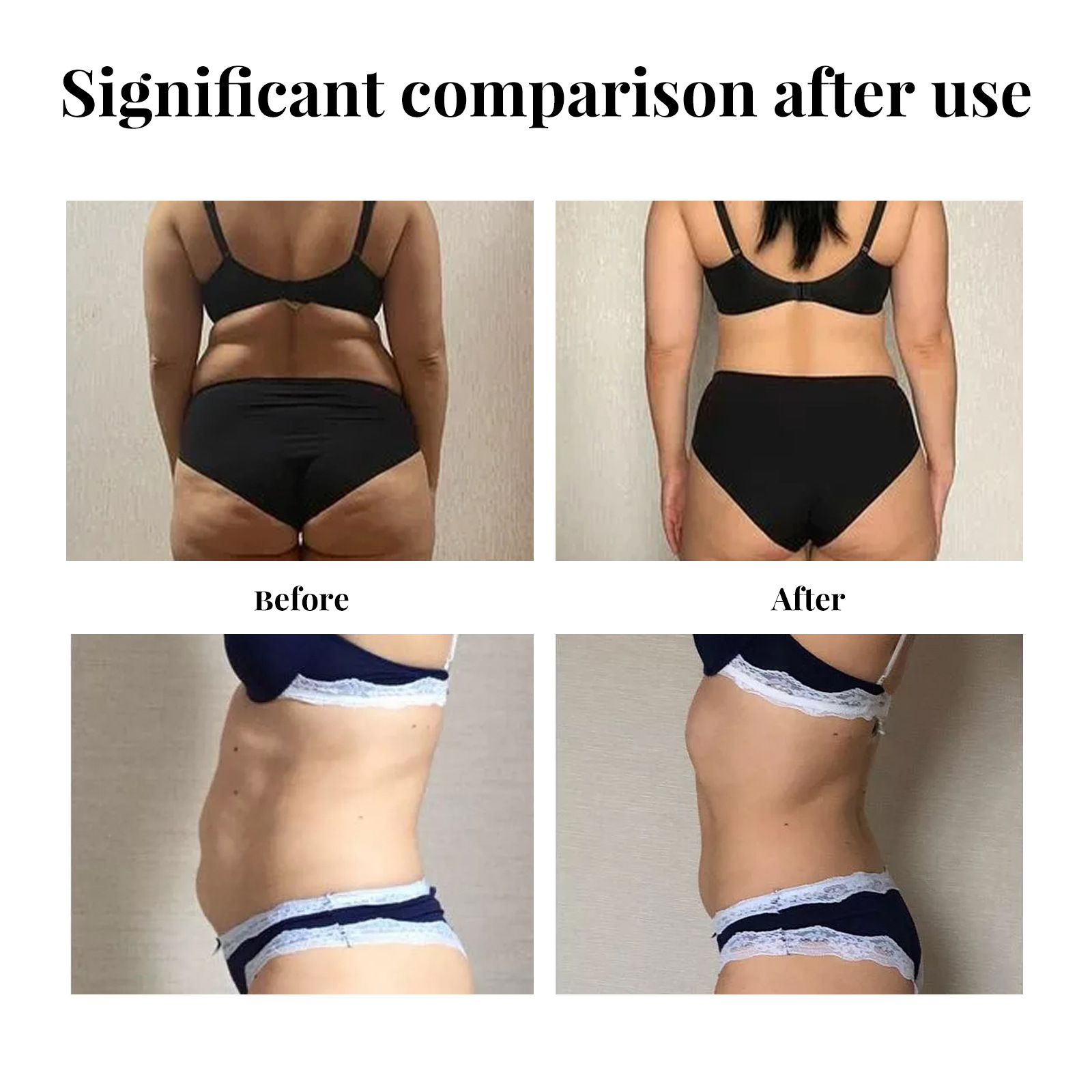 EELHOE belly lifting patch lifting loose skin firming big belly shaping navel patch slim fit patch