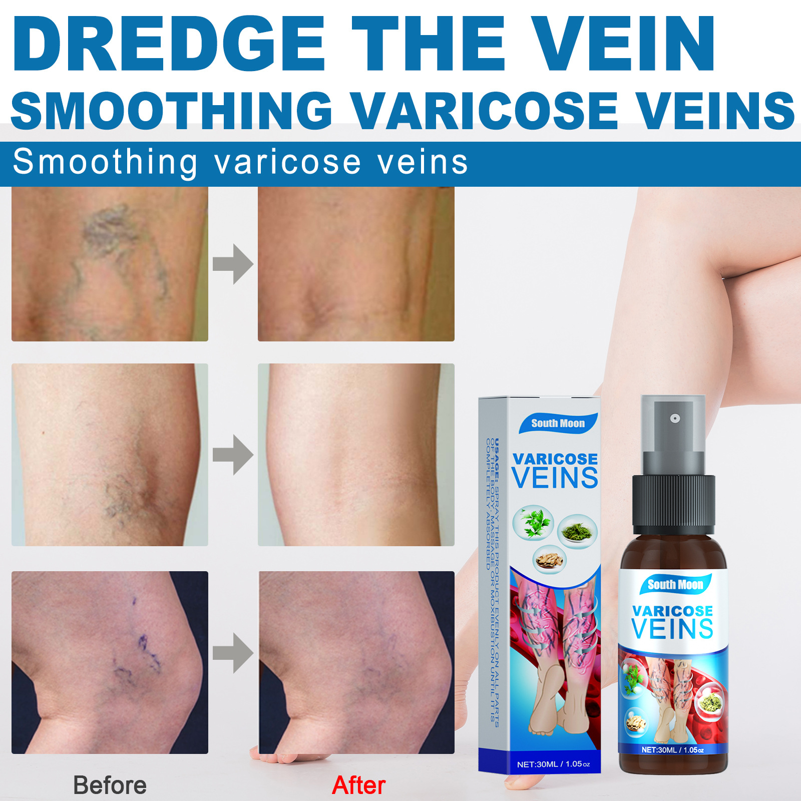South Moon intravenous spray relieving Qu Zhang Fuping blood vessel bulge earthworm leg leg massage spray