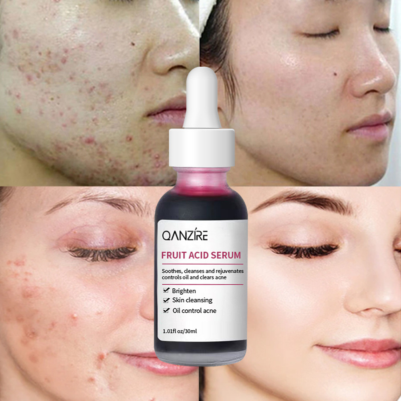 Cross-border foreign trade fruit acid essence liquid acne fruit acid essence almond acid essence in stock