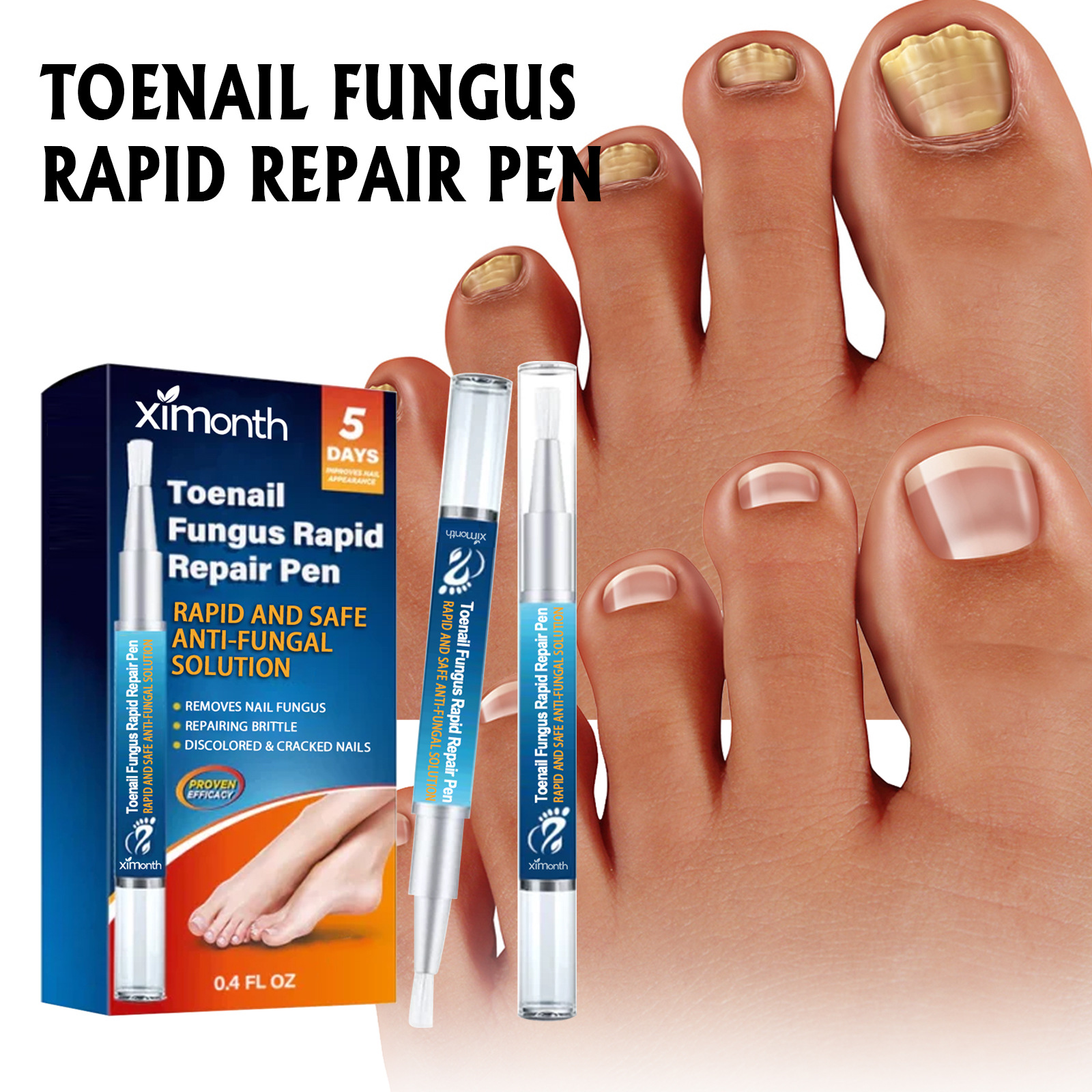 Ximonth nail repair pen repair inlay thickened moisturizing repair dead skin hand and foot gray nail care