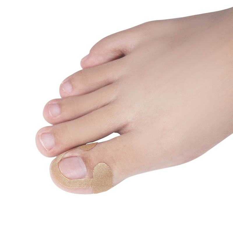 Nail groove nail inlay toe correction stickers unisex nail groove nail self-adhesive prevention nail nail nail tie into meat