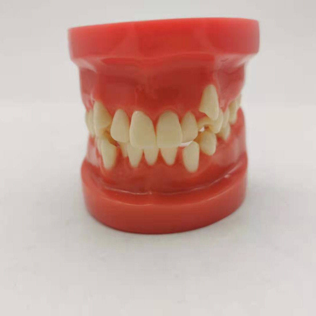 Dental red wrong jaw model oral teaching model children wrong jaw model dental wrong jaw buck teeth