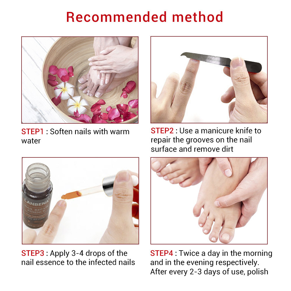 LANBENA Blue Beina Nail Care Solution with 1 Small File 15ml (New Package)