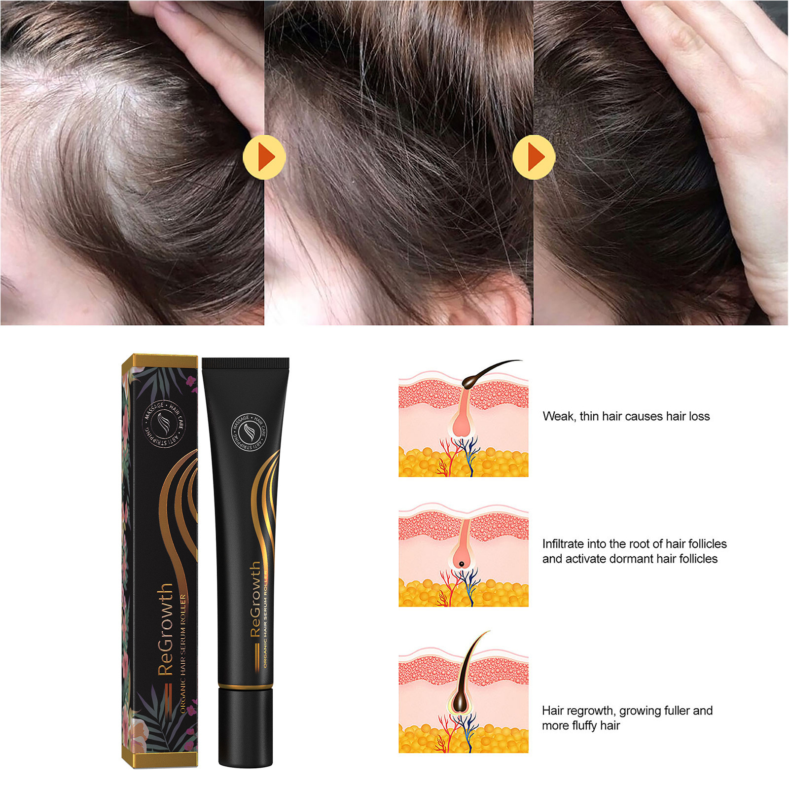 EELHOE ball massage thick long hair liquid thick sparse hair anti-hair breaking hair nourishing hair bead massage care