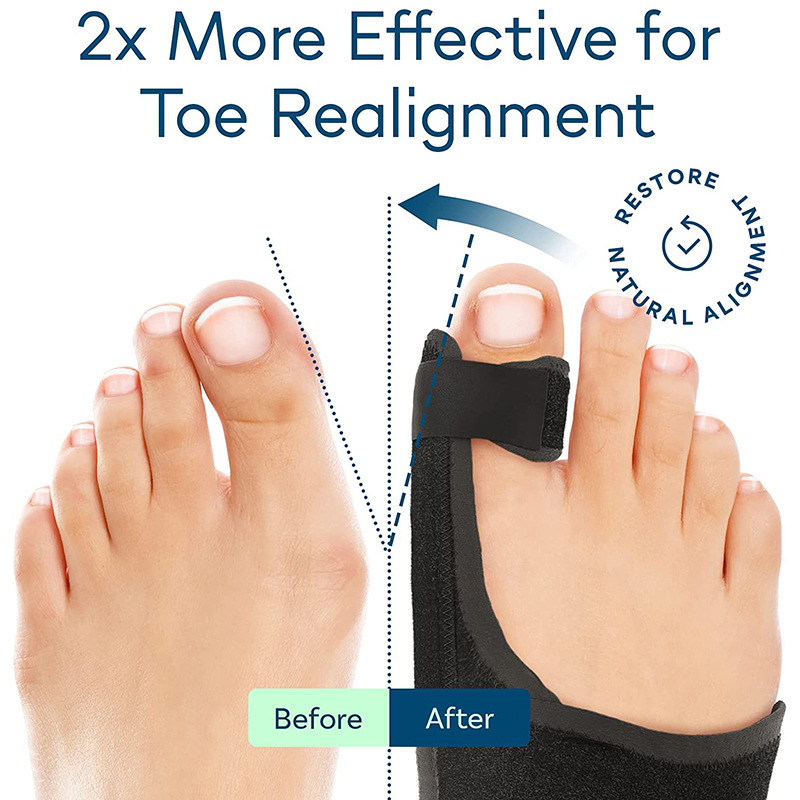 Big toe corrector hallux valgus correction belt big foot bone corrector hallux valgus toe splitter separator