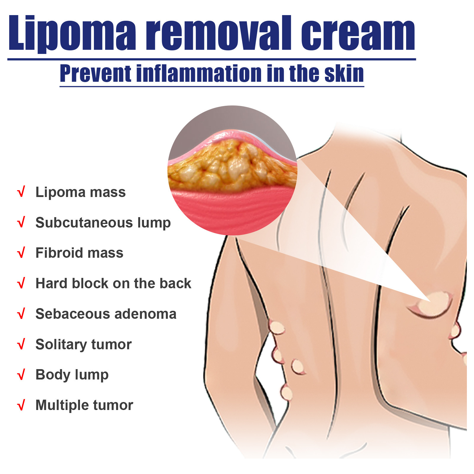 South Moon Fat Paste Repair and Dredge Fat Cough Cough Nodules Subcutaneous Masses Body Care Paste